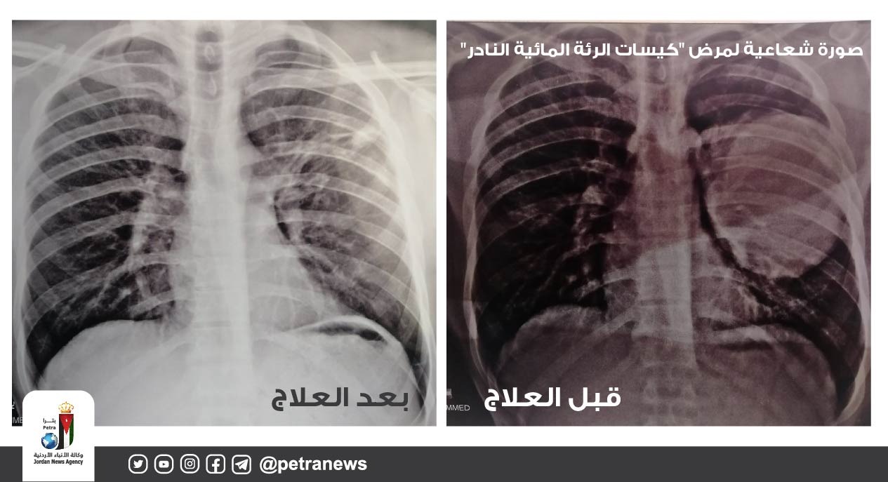 Madar Al-Saa Images 0.4695109214636184