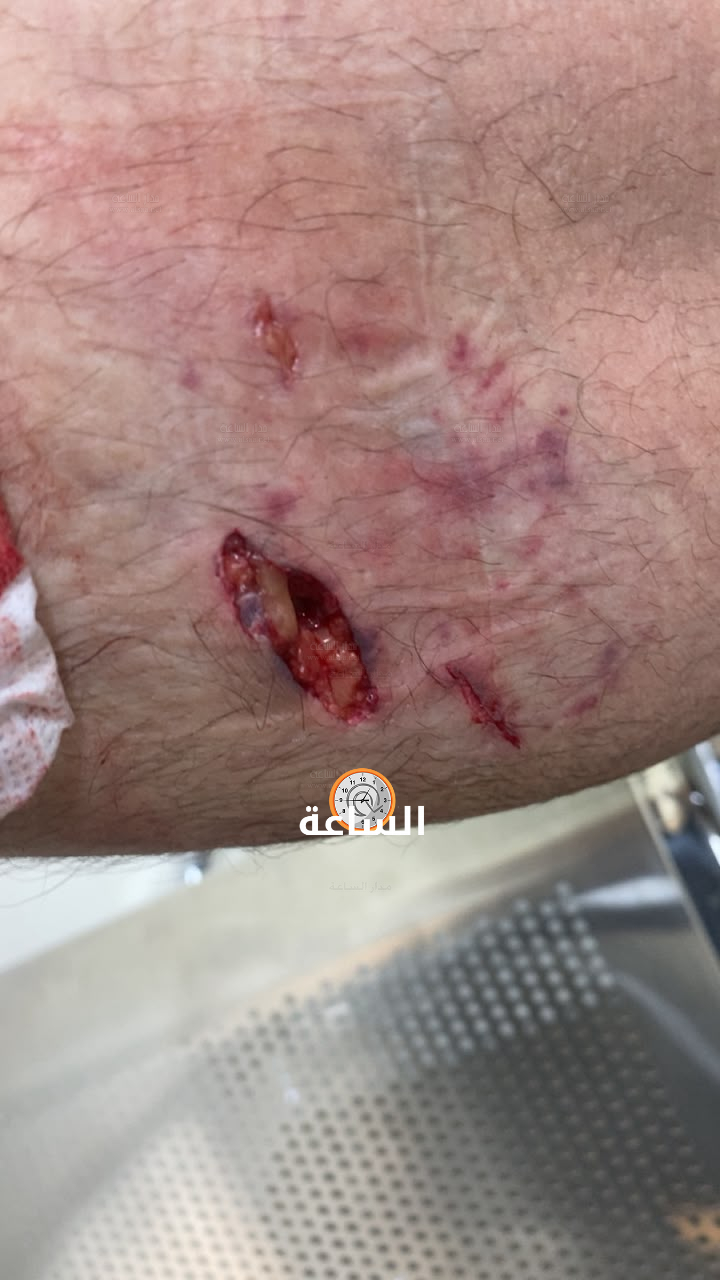 Madar Al-Saa Images 0.5130109002614669