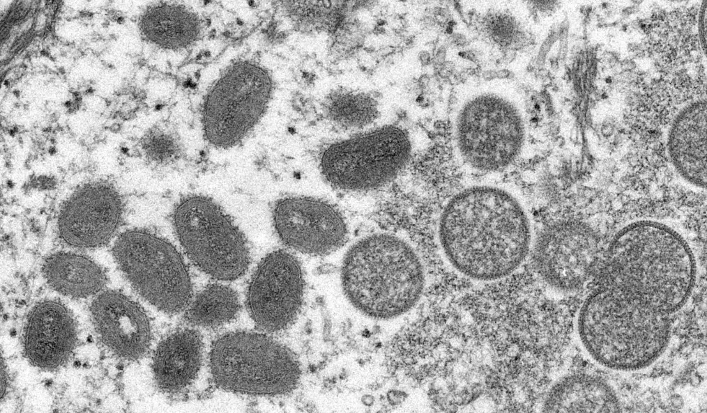 مدار الساعة,أخبار عربية ودولية,جدري القردة,منظمة الصحة العالمية