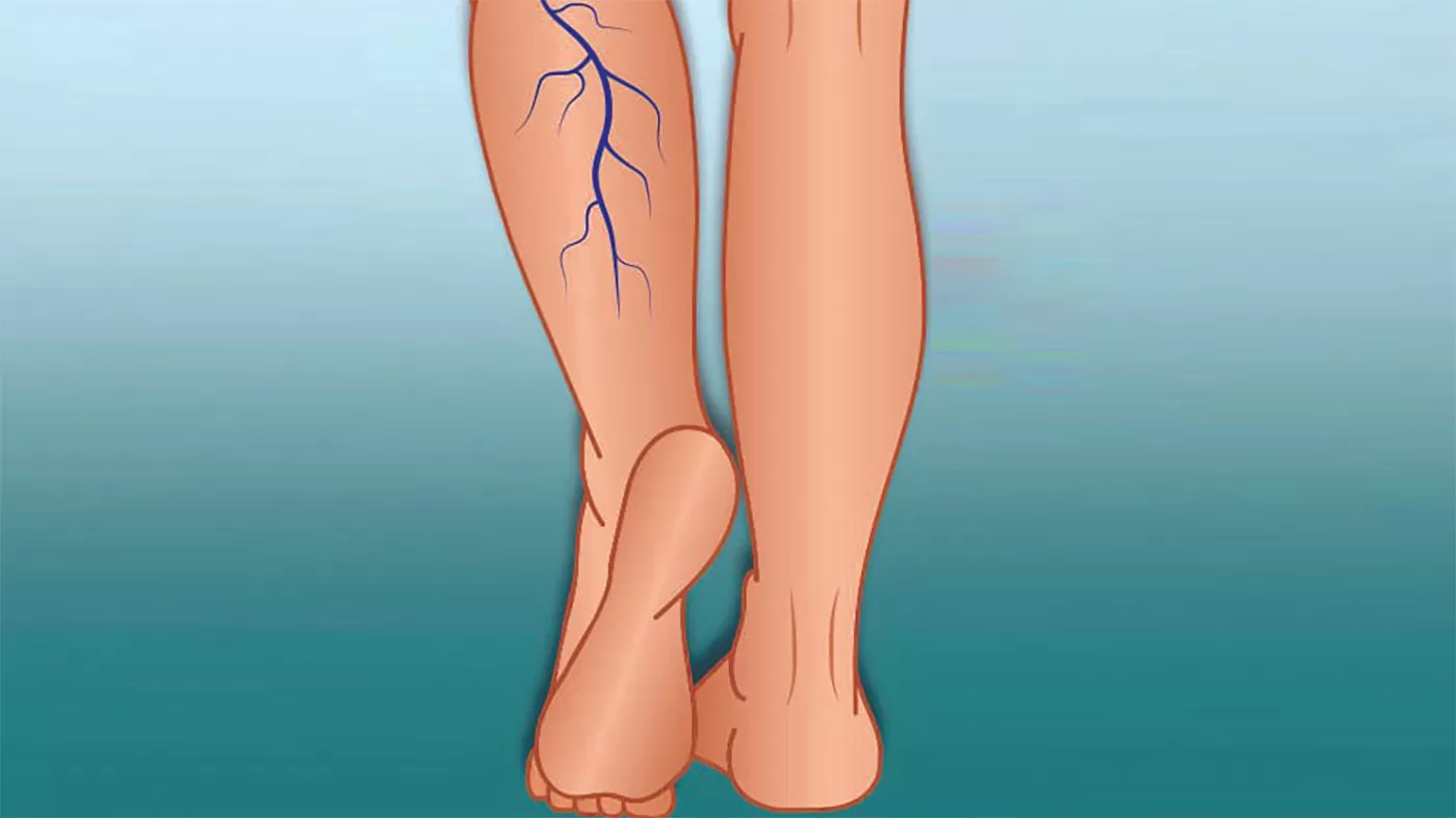 مدار الساعة,أخبار الأسرة