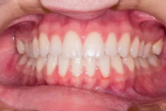 مدار الساعة,أخبار الأسرة