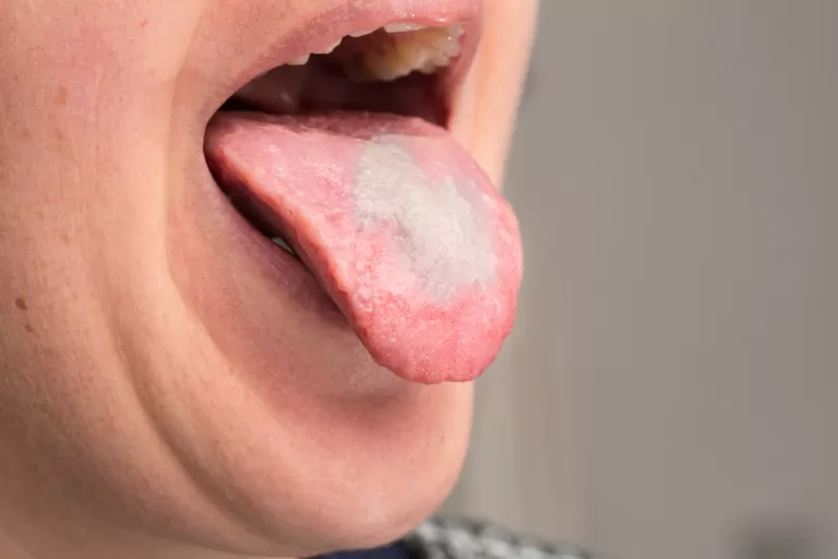 مدار الساعة,أخبار الأسرة