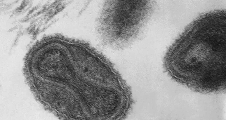 مدار الساعة,أخبار عربية ودولية,جدري القردة,الاتحاد الأوروبي,منظمة الصحة العالمية