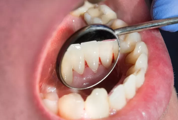 مدار الساعة,أخبار الأسرة