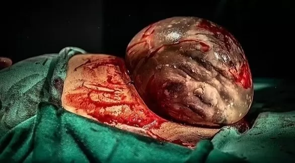 مدار الساعة,أخبار الأسرة