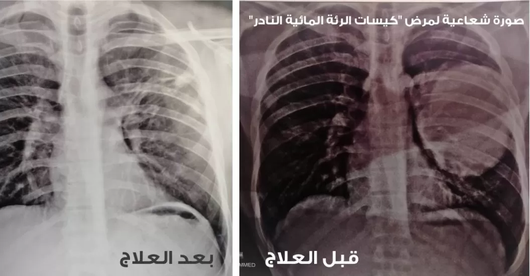 مدار الساعة,أخبار الصحة والأسرة,وزارة الصحة,وكالة الأنباء الأردنية