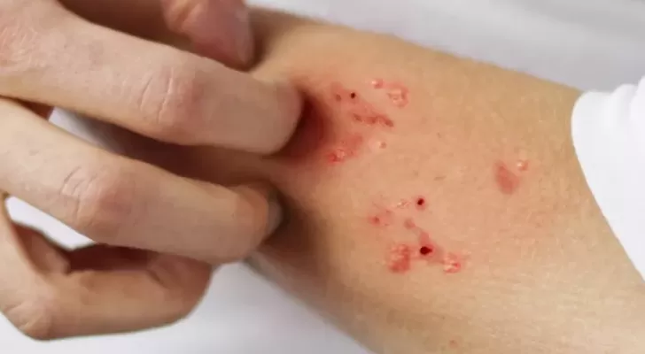 مدار الساعة,أخبار الأردن,اخبار الاردن,وزارة الصحة