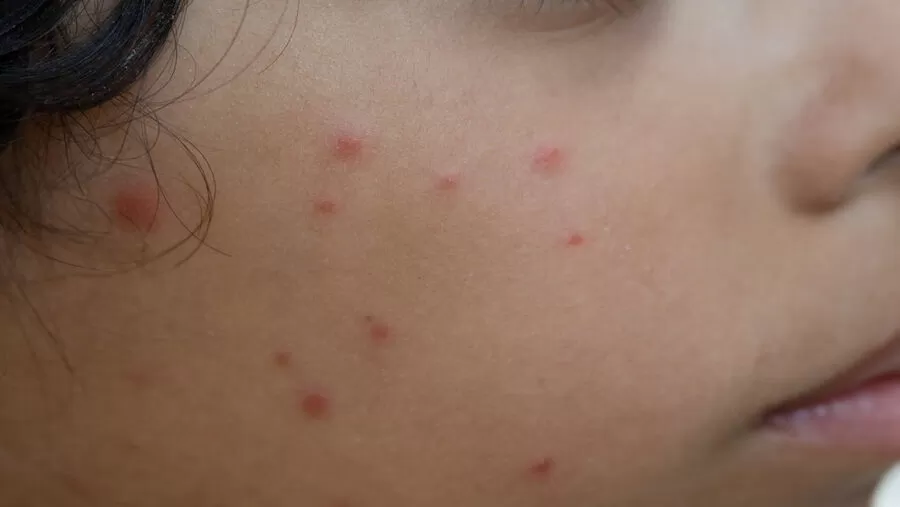 مدار الساعة,أخبار الصحة والأسرة,دائرة الإحصاءات العامة,وزارة الصحة,المستشفيات الخاصة