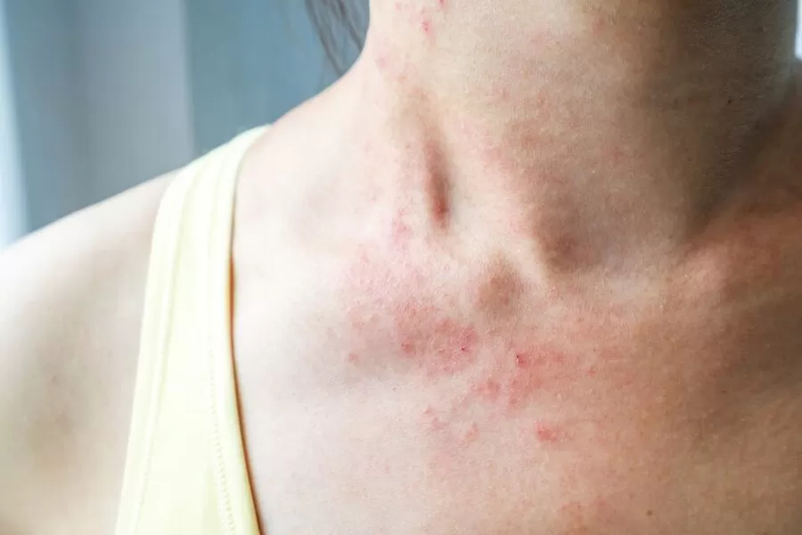 مدار الساعة,أخبار الأسرة,#متلازمة_سويت #العناية_بصحة_الأسرة #التشخيص_والعلاج