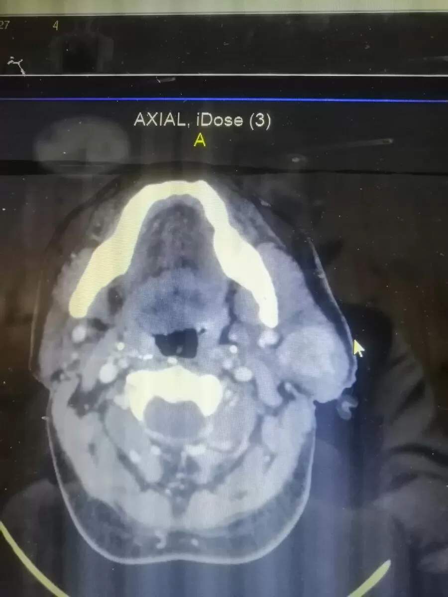 مدار الساعة,أخبار الأردن,اخبار الاردن,الملك عبد الله الثاني,الجيش العربي,المستشفى الميداني الأردني