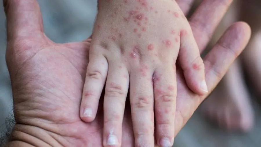 مدار الساعة,أخبار الأردن,اخبار الاردن,وزارة الصحة