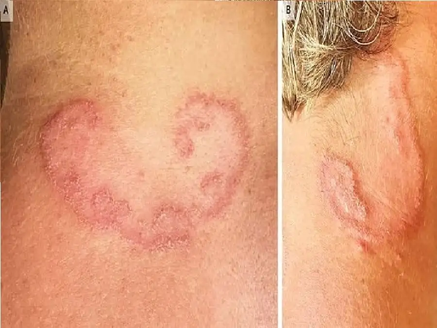مدار الساعة,أخبار الأسرة