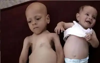 مأساة عبدالله وحبيبة أبوزرقة.. هل من