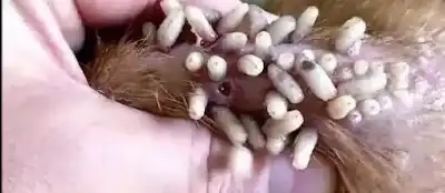 آكل للحم.. أميركا تؤكد أول إصابة