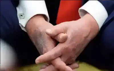 ترامب ميت أم حي؟