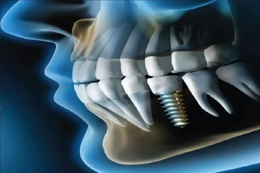 مدار الساعة,أخبار الصحة والأسرة,الذكاء الاصطناعي