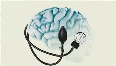 القاتل الصامت للدماغ: ضغط الدم المرتفع