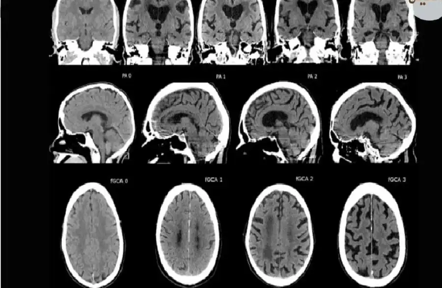 مدار الساعة,أخبار التكنولوجيا، التقنيات,الذكاء الاصطناعي