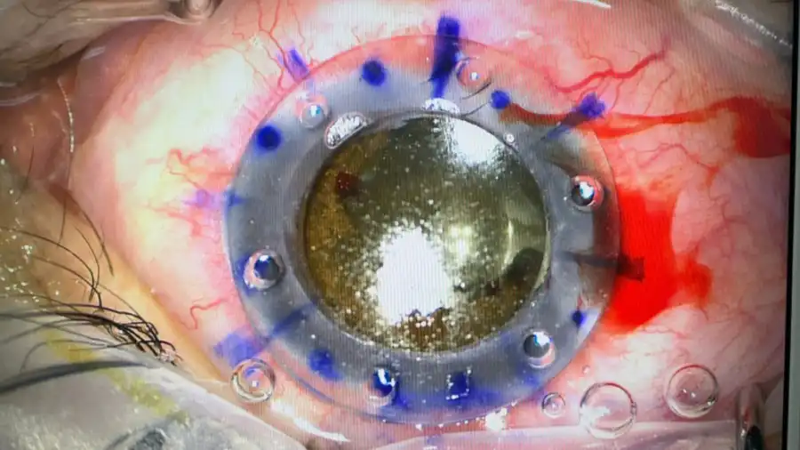 مدار الساعة,أخبار الأردن,اخبار الاردن,أخبار الصحة والأسرة,الملك المؤسس