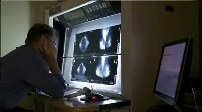 نبوءة هينتون الخاطئة.. كيف تحول أطباء