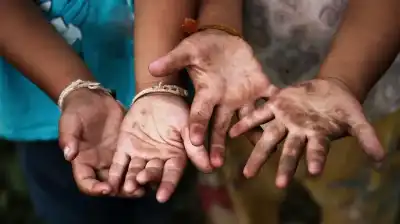 مركز حقوق الإنسان: 75 ألف طفل