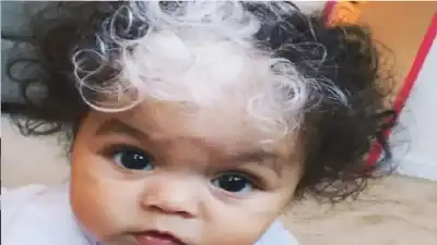 لغز الخصلة البيضاء.. ما هي ظاهرة