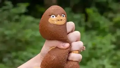 حروق مروّعة لطفلة بسبب ترند Squishy