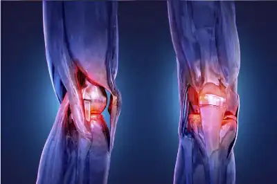 بديل آمن للأدوية والجراحة.. الإشعاع بجرعات