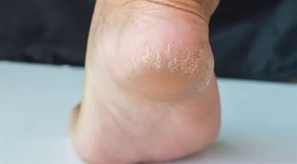 مدار الساعة,أخبار الأسرة