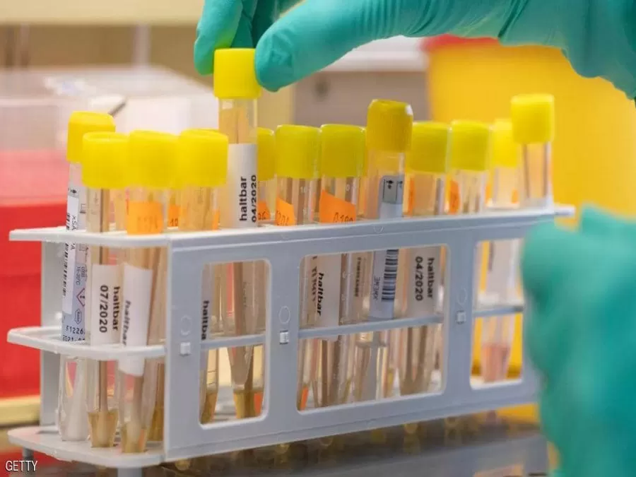 مدار الساعة,أخبار عربية ودولية,كورونا,كوفيد 19