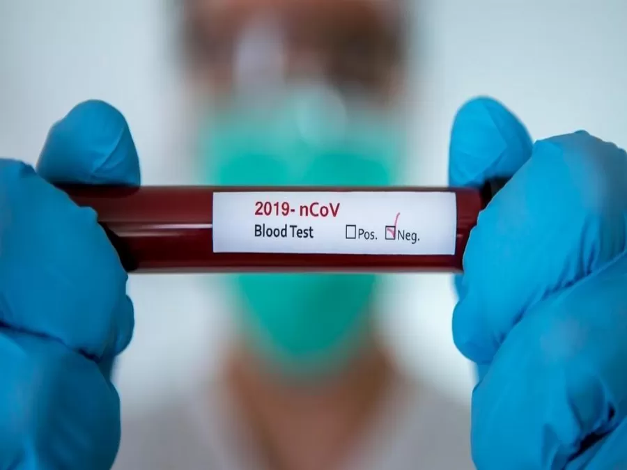 مدار الساعة,أخبار عربية ودولية,كورونا