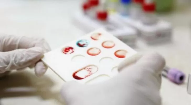 مدار الساعة,أخبار خفيفة ومنوعة,كورونا,الاتحاد الأوروبي