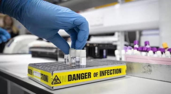 مدار الساعة,أخبار خفيفة ومنوعة,كورونا,كوفيد 19