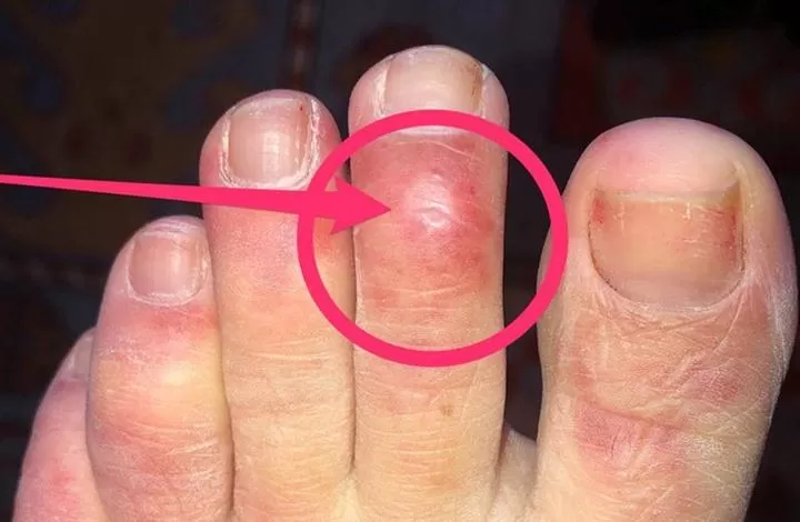 مدار الساعة,أخبار خفيفة ومنوعة,كورونا