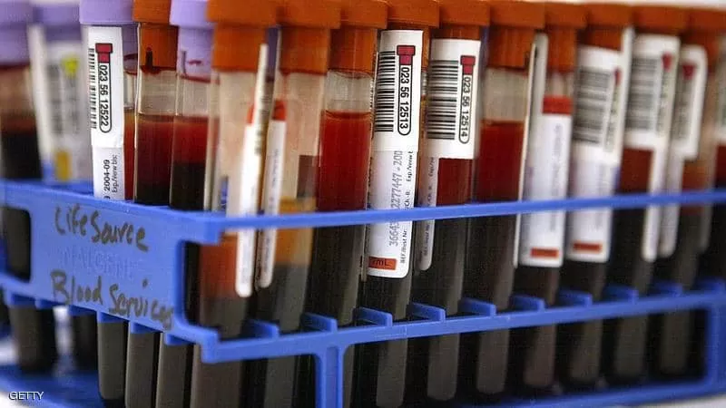 مدار الساعة,أخبار خفيفة ومنوعة,كورونا