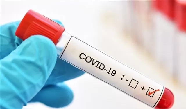 مدار الساعة,أخبار عربية ودولية,كورونا,وكالة الأنباء الأردنية