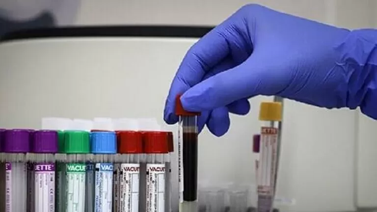 مدار الساعة,أخبار عربية ودولية,كورونا,وزارة الصحة,منظمة الصحة العالمية