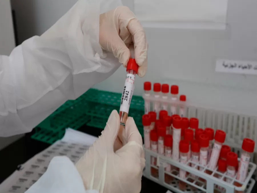 مدار الساعة,أخبار عربية ودولية,وزيرة الصحة,كورونا,وزارة الصحة,قطاع غزة