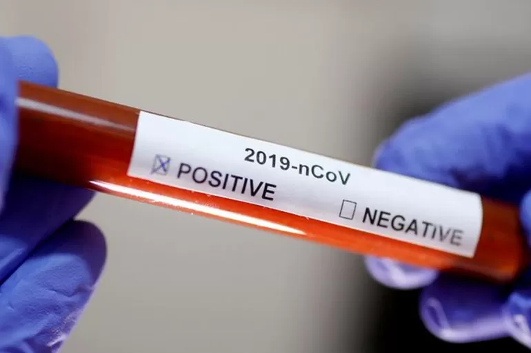 مدار الساعة,أخبار الأردن,اخبار الاردن,كورونا