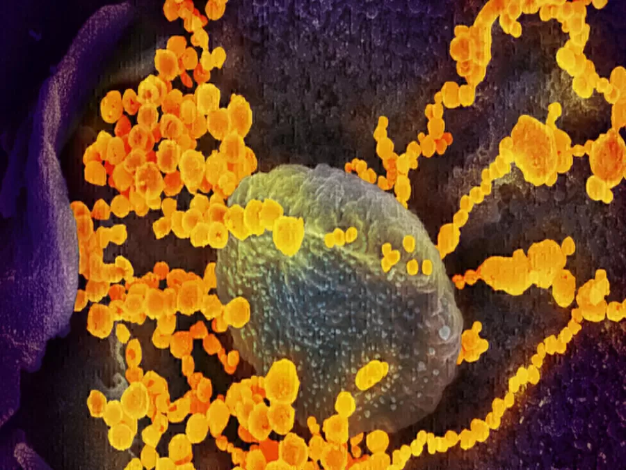 مدار الساعة,أخبار عربية ودولية,كورونا