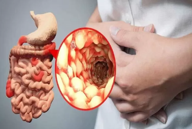 مدار الساعة,أخبار الأسرة
