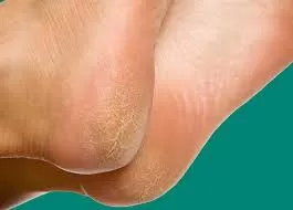 مدار الساعة,أخبار الأسرة