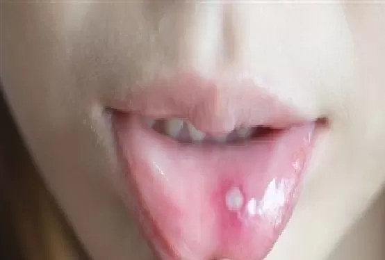 مدار الساعة,أخبار الأسرة