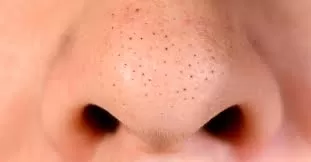 مدار الساعة,أخبار الأسرة