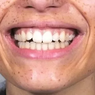 مدار الساعة,أخبار الأسرة