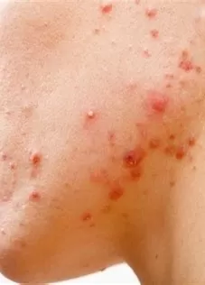 مدار الساعة,أخبار الأسرة