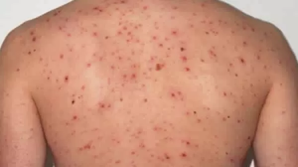 مدار الساعة,أخبار الأردن,اخبار الاردن,وزارة الصحة,وكالة الأنباء الأردنية