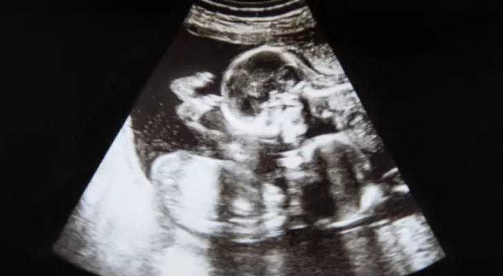 مدار الساعة,Video,فيديو,أخبار خفيفة ومنوعة