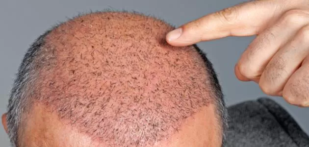 مدار الساعة,أخبار الأسرة