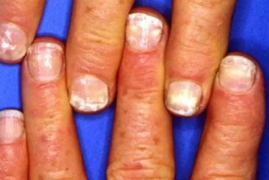 مدار الساعة,أخبار خفيفة ومنوعة